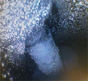 黑不溜秋的還有粉末狀，好惡心~  